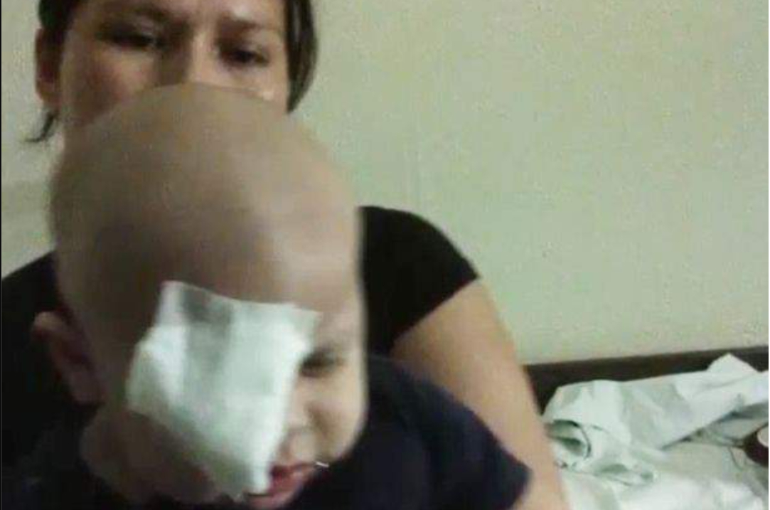 1-årig har en tumor bag det ene øje og skulle opereres: Så gør lægen det utilgivelige