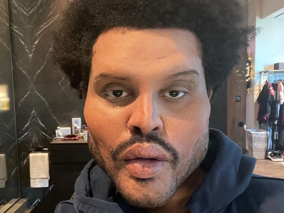 Fans i chok: Hvad er der sket med The Weeknd?