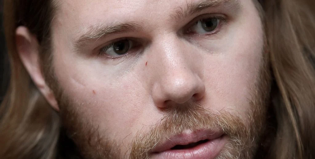 Det har vækket stor undren: Nu er der nyt om Mikkel Hansen