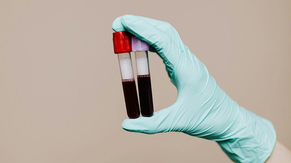 ‘Værdifuldt værktøj’ har set dagens lys: Sådan kan helt ny test afsløre kræft
