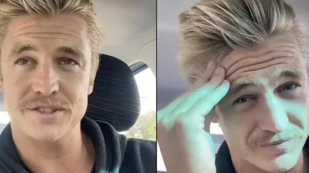 Nick har ikke vasket hår i 6 år: Du vil ikke tro dine egne øjne, når du ser det
