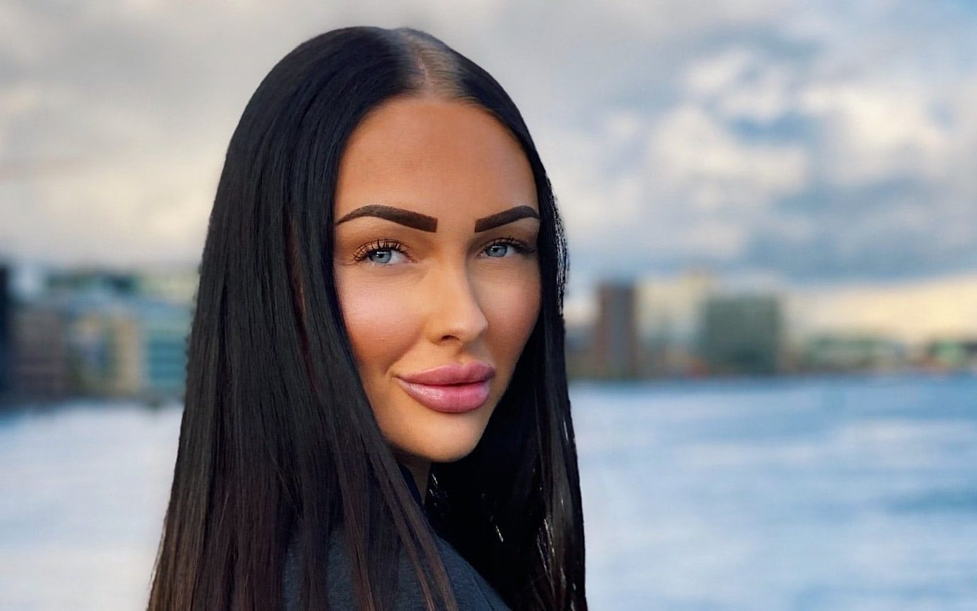 Før- og efterbilleder: Realitybabe i stort vægttab