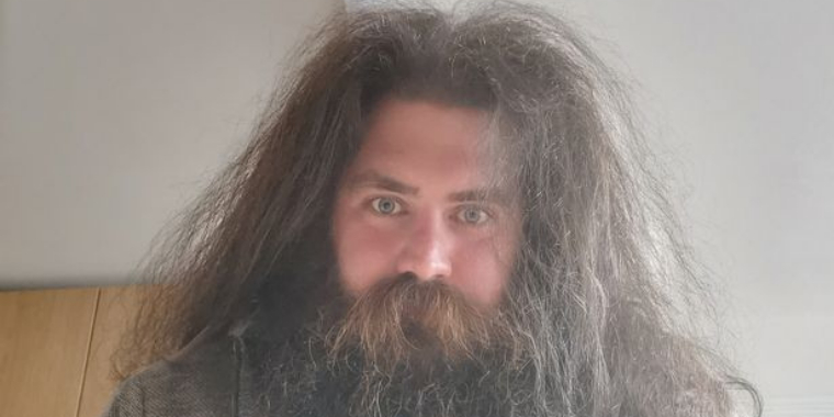 Kan du også se det? 32-årig mand bliver konstant stoppet på gaden