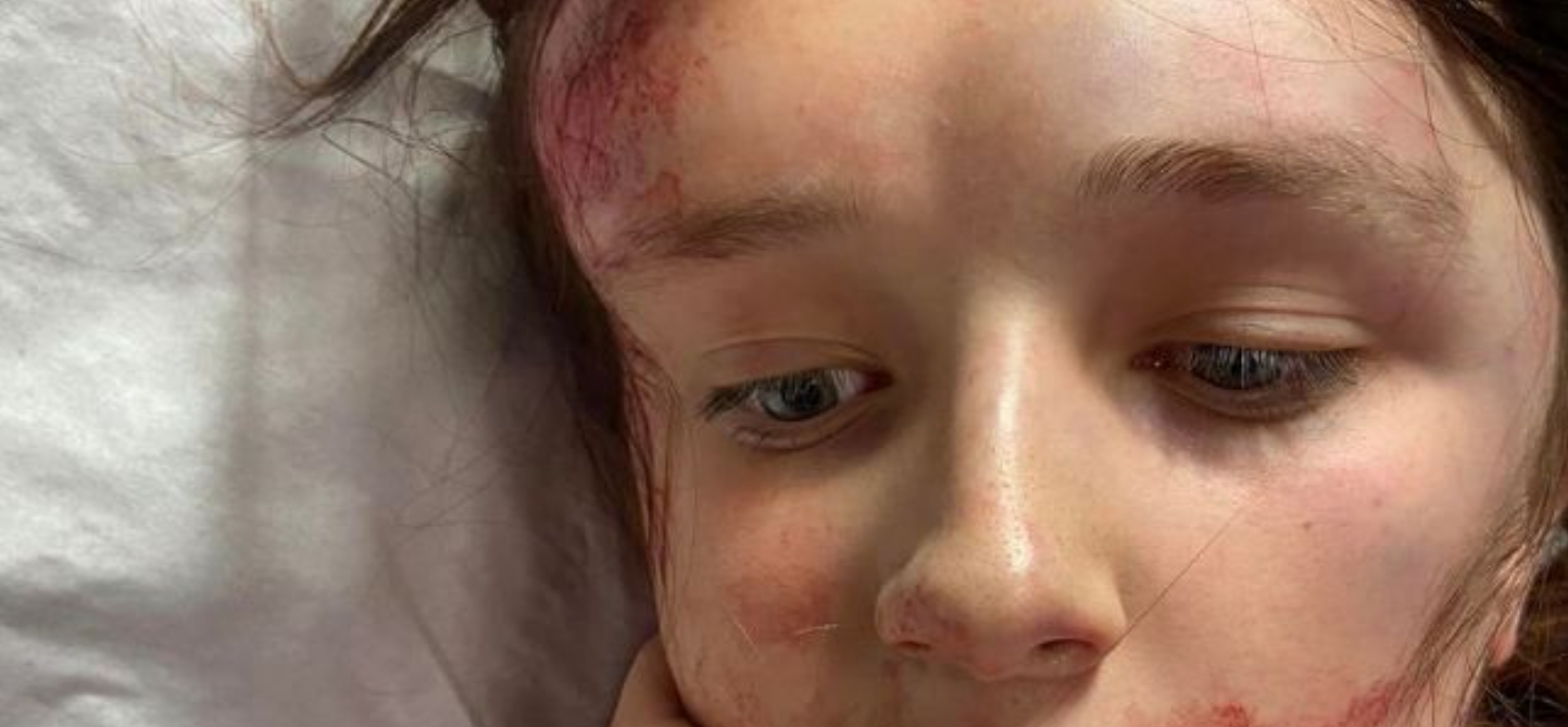 12-årig autistisk pige skulle mødes med veninde: Hun blev filmet og banket til bevidstløshed