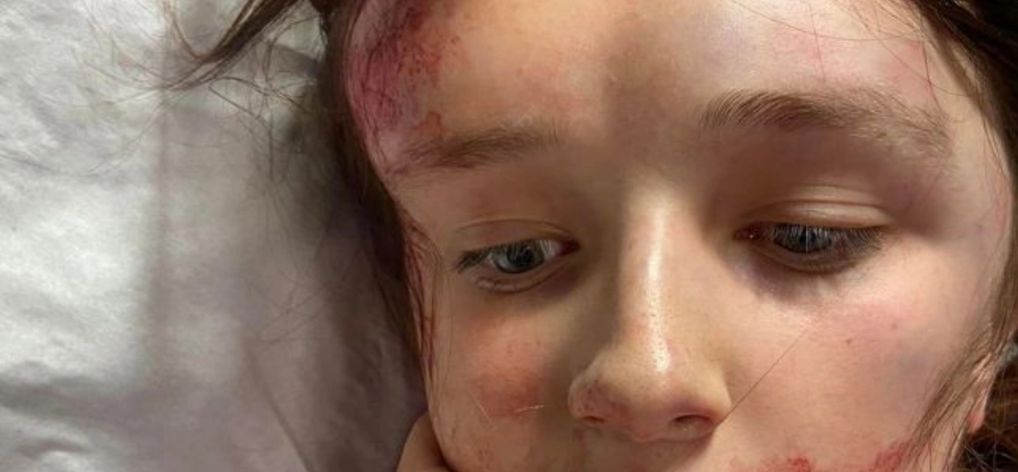 12-årig autistisk pige skulle mødes med veninde: Hun blev filmet og banket til bevidstløshed