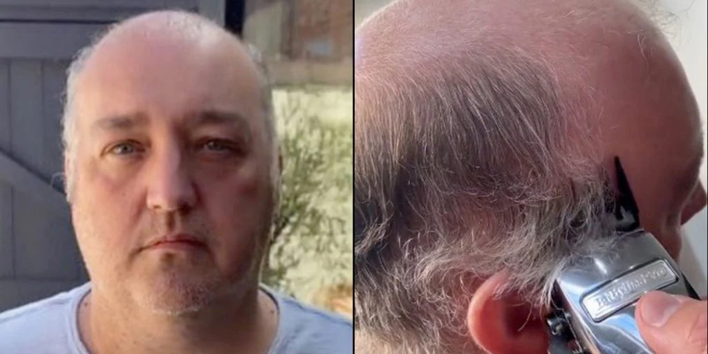 42-årig mand overrasker med vild forvandling: Nu ser han ’20 år yngre ud’