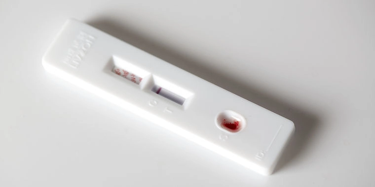 Nu kan du se, om du har været smittet med coronavirus