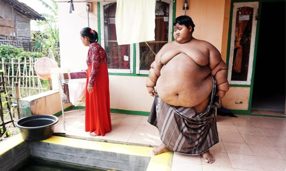Han var verdens tykkeste barn som 9-årig og vejede 190 kilo:I dag er han uigenkendelig