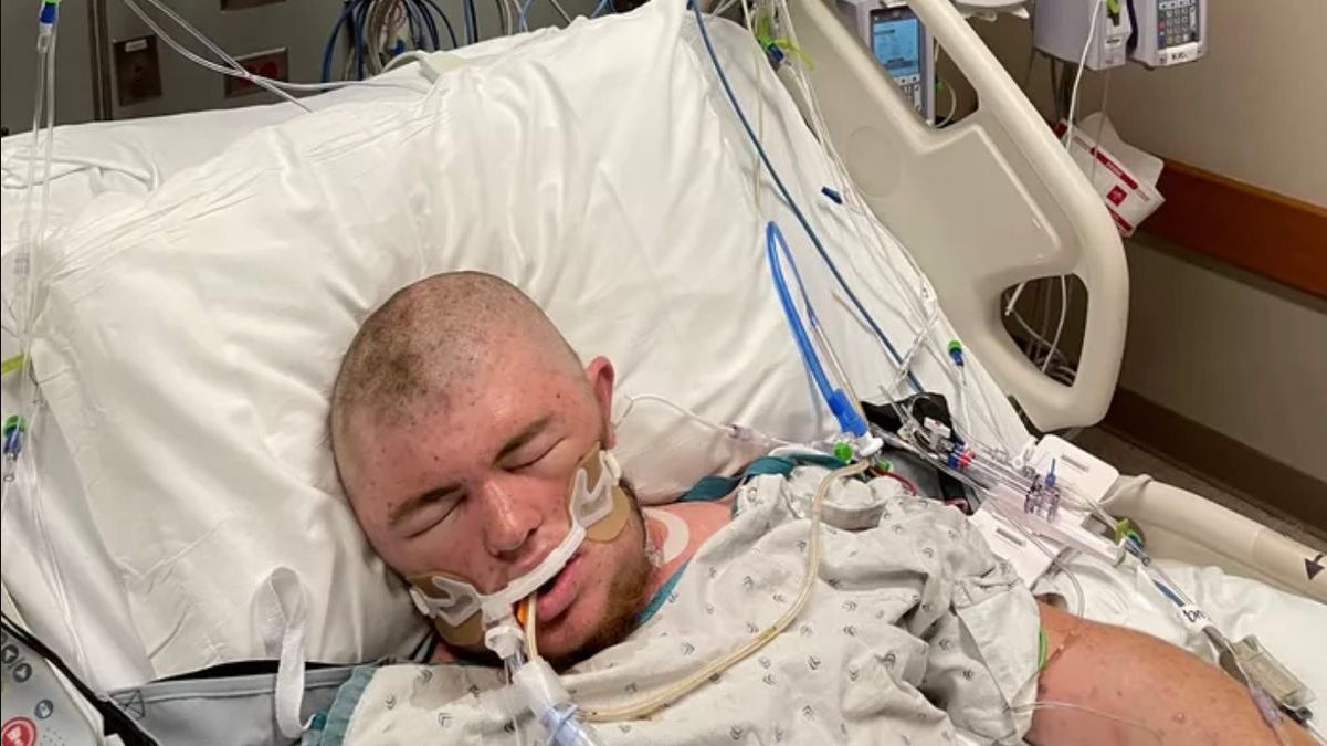 Mand kæmper for sit liv: Blev stukket 20.000 gange