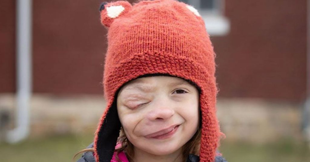 Mobning af værste skuffe: 10-årig bliver ofte kaldet ‘Elefantmanden’