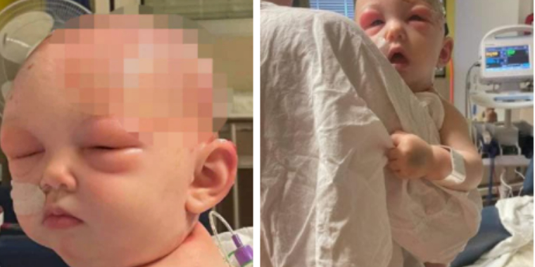 Baby fik fat i hårtørrer: Så gik det helt galt