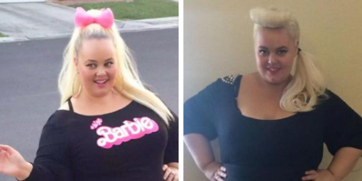 Kvinde taber 90 kilo: ‘Jeg vil ligne en barbiedukke’
