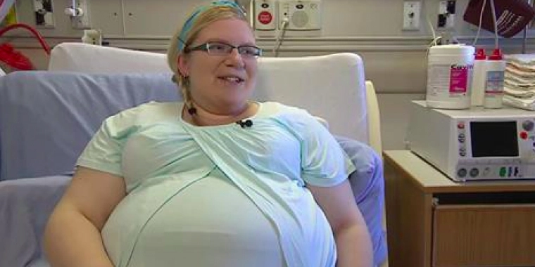 Ekstremt sjælden graviditet: Sker kun én ud af 67 millioner gange