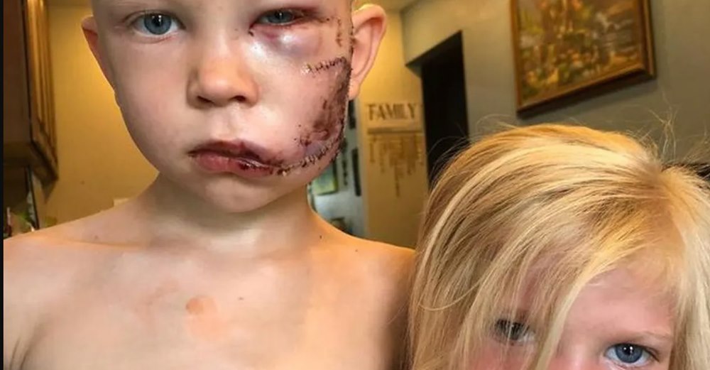 Billedet gik verden rundt: Sådan ser han ud i dag