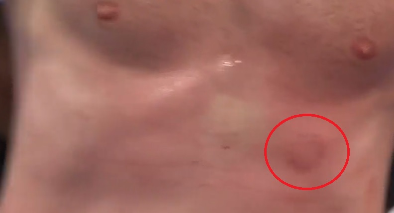 Ren Mike Tyson: Se boksestjerne bide sin modstander flere gange!