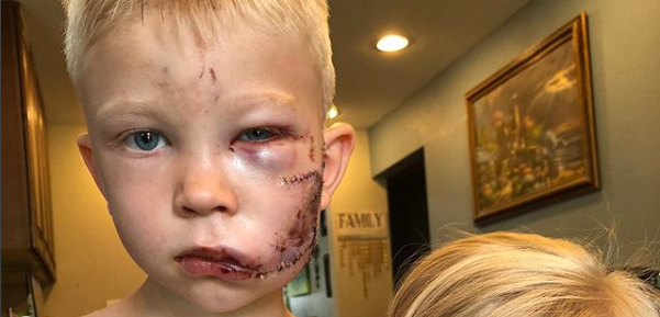 6-årig dreng redder lillesøster: ”Hvis der var nogen, der skulle dø, skulle det være mig”