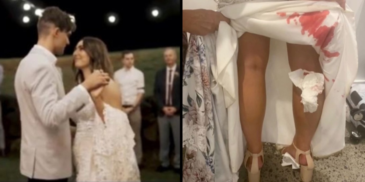 Pludselig var brud dækket af blod: Årsagen viste sig at være virkelig ulækker