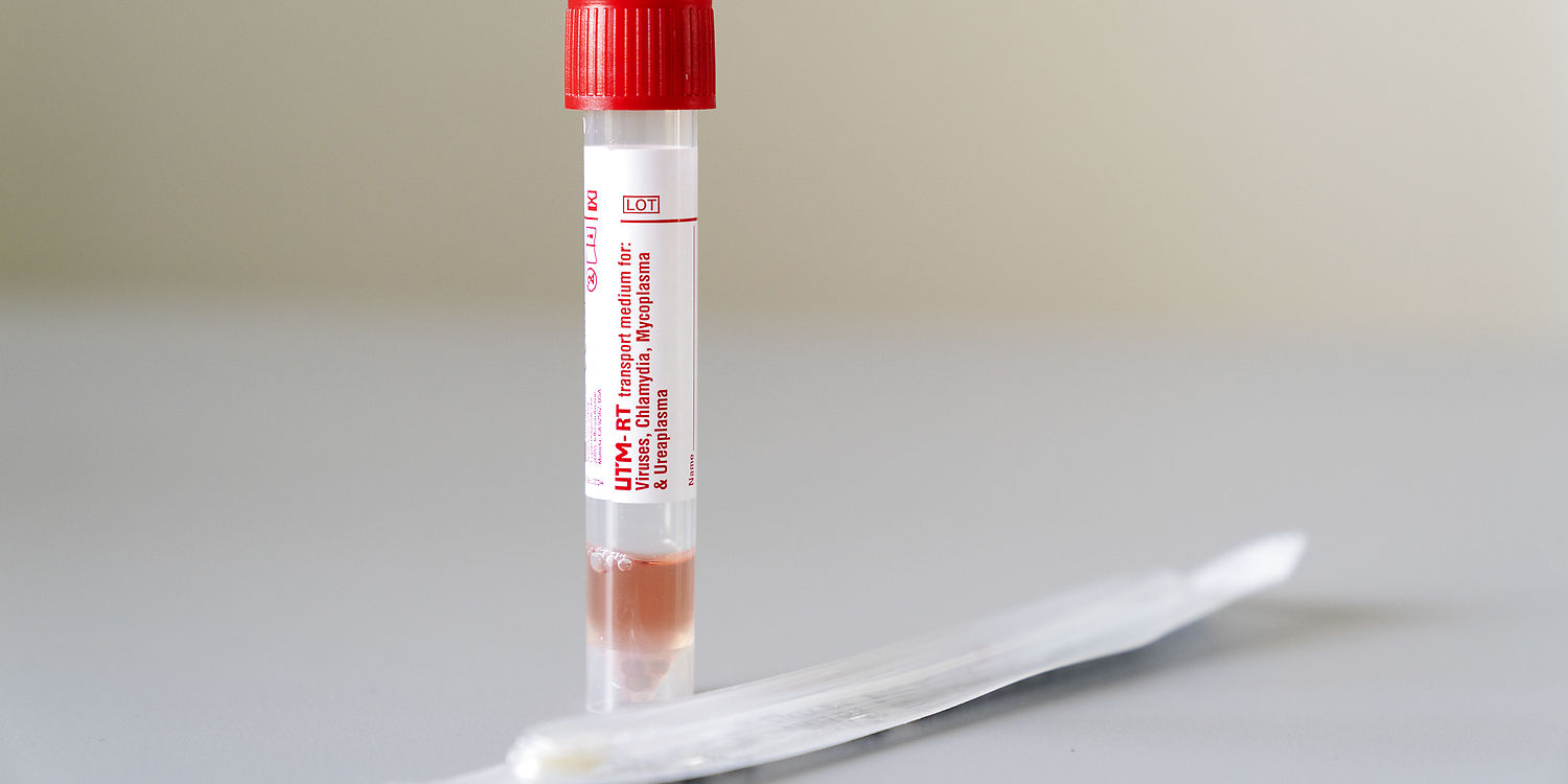 Hold øje med disse nye symptomer på coronavirus