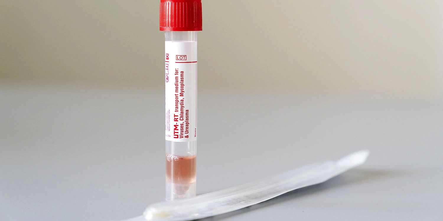 Hold øje med disse nye symptomer på coronavirus
