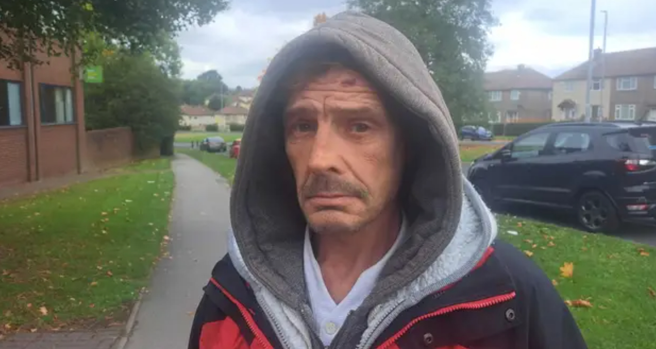 David kunne ikke få en tandlægetid i over 10 år: Så tog han sagen i egen hånd