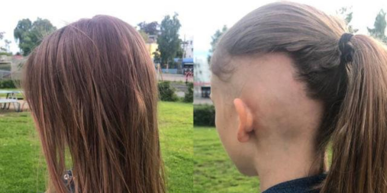 Pludselig mistede 10-årig Maria sit hår