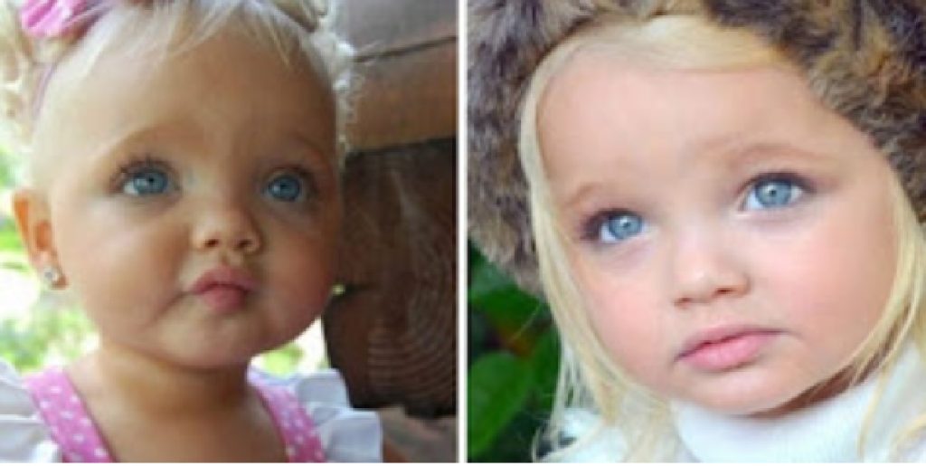 Den 2-årige pige blev kaldt virkelighedens dukke – men bare vent til du ser hende i dag 12 år senere