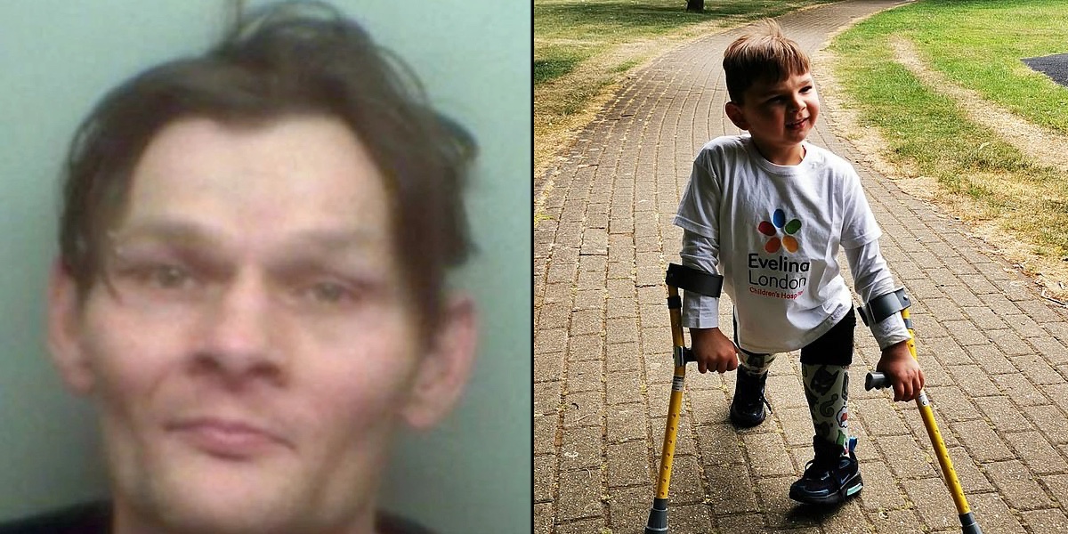 Mishandlede sin søn, så hans ben måtte amputeres: Nu har han fået tæsk i fængslet