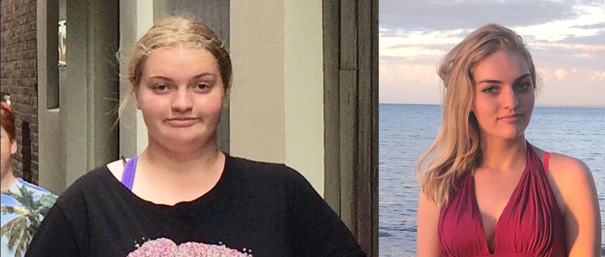 16-årig Josie blev mobbet ud af skolen på grund af sin vægt: I dag er hun ikke til at kende