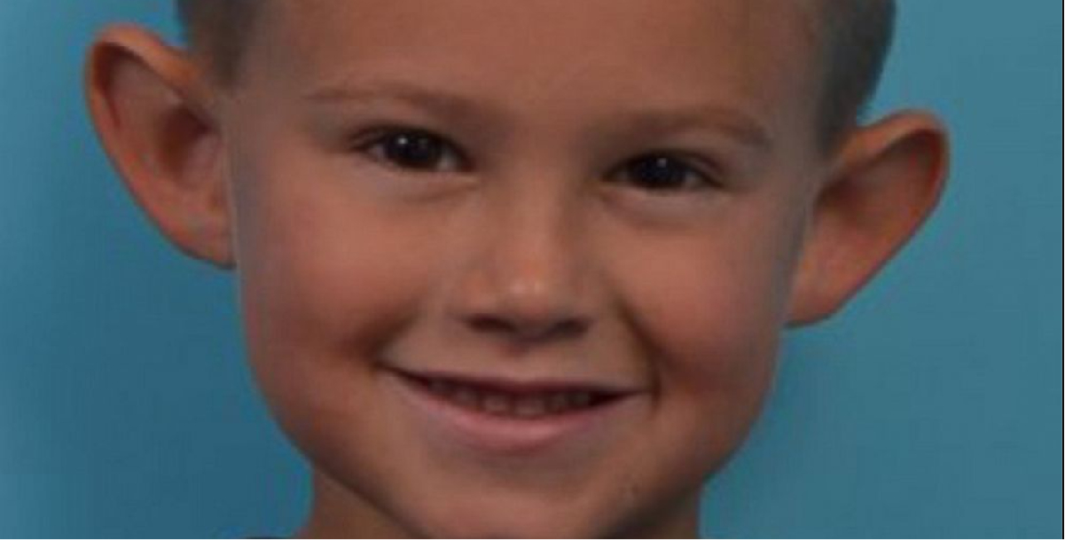 6-årig blev mobbet og kaldt ‘Dumbo’ af sine klassekammerater: I dag er han uigenkendelig