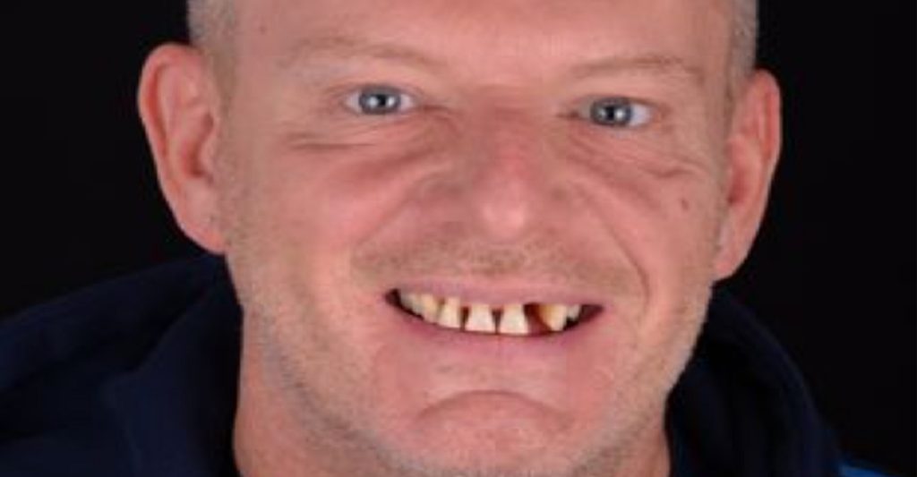 Mand var misbruger af narkotika og alkohol i 10 år: Nu er han uigenkendelig