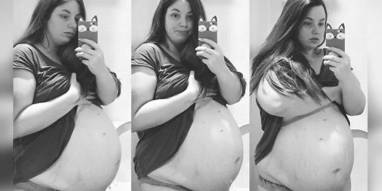 22-årig mor er gravid for fjerde gang – men så afslører lægerne detaljen på ultralydsbilledet