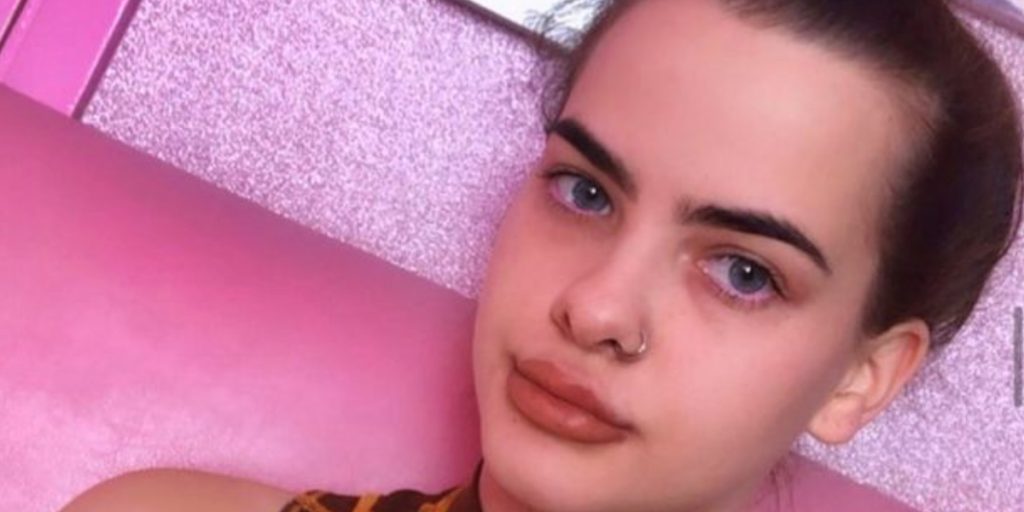 Blev mobbet med sin store pande: Så tog hun en drastisk beslutning