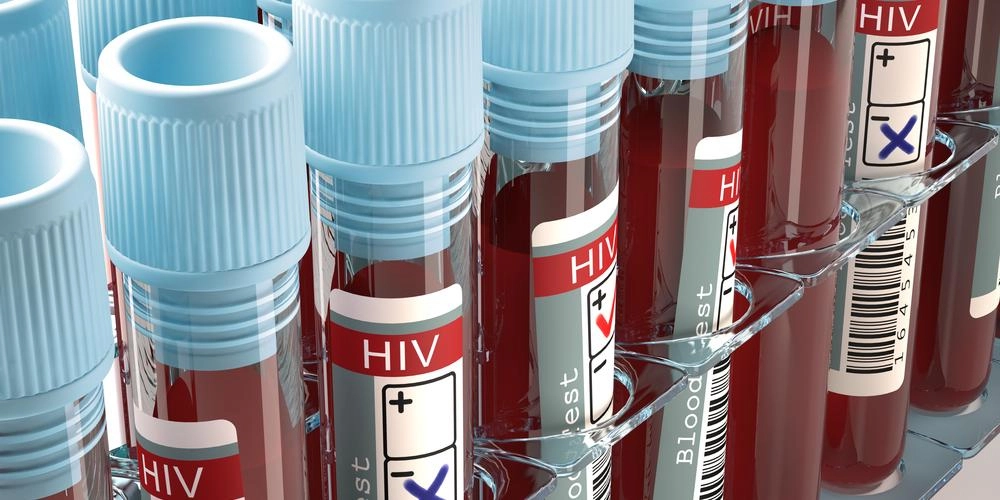 Ny HIV-variant truer med hurtigere udvikling af AIDS