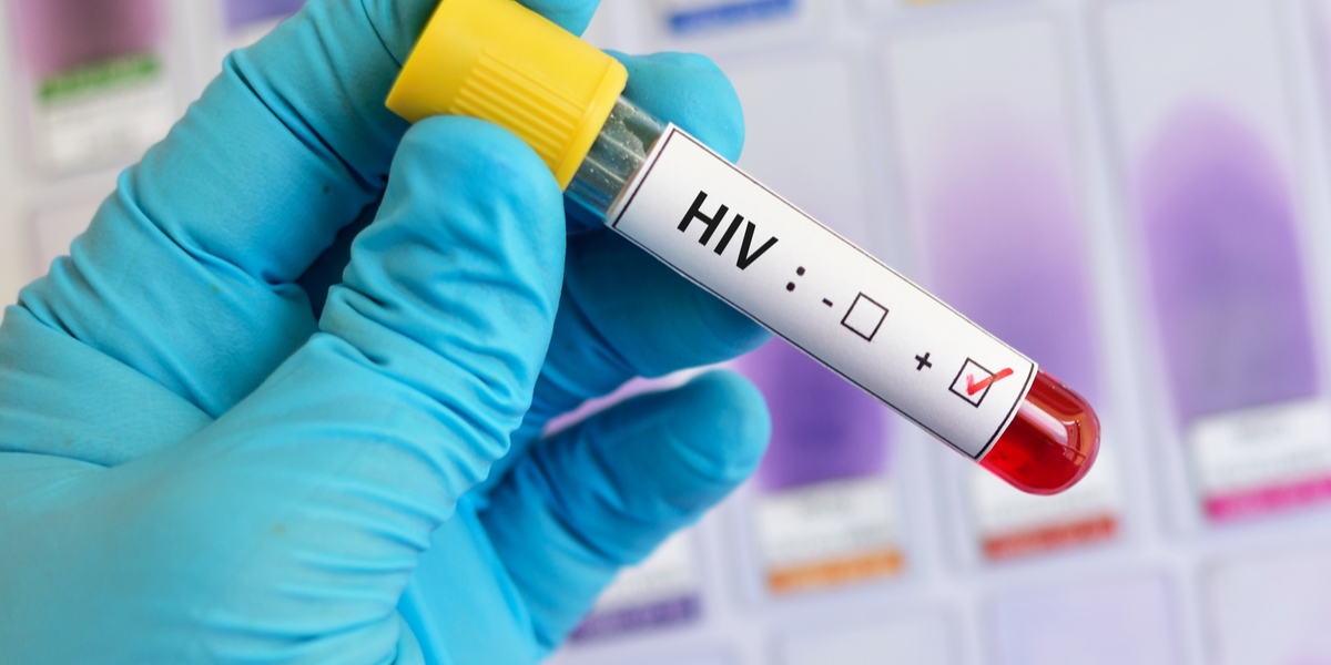 Verdens mest uheldige mand: Tester positiv for abekopper, Covid-19 og HIV – på samme tid