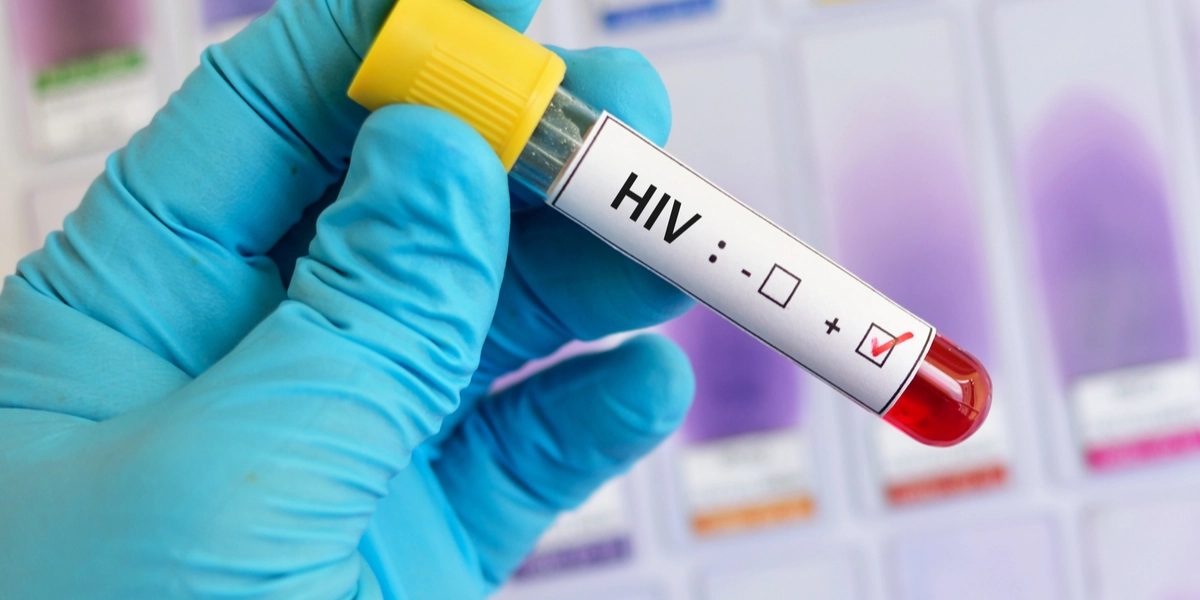 Verdens mest uheldige mand: Tester positiv for abekopper, Covid-19 og HIV – på samme tid