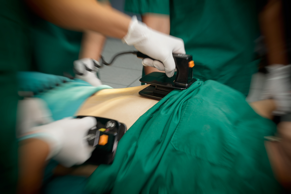 Læge får hjerteanfald, mens han prøver at redde patient med hjerteanfald