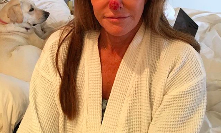 Caitlyn Jenner chokerer med uhyggelig selfie: Glem aldrig dette