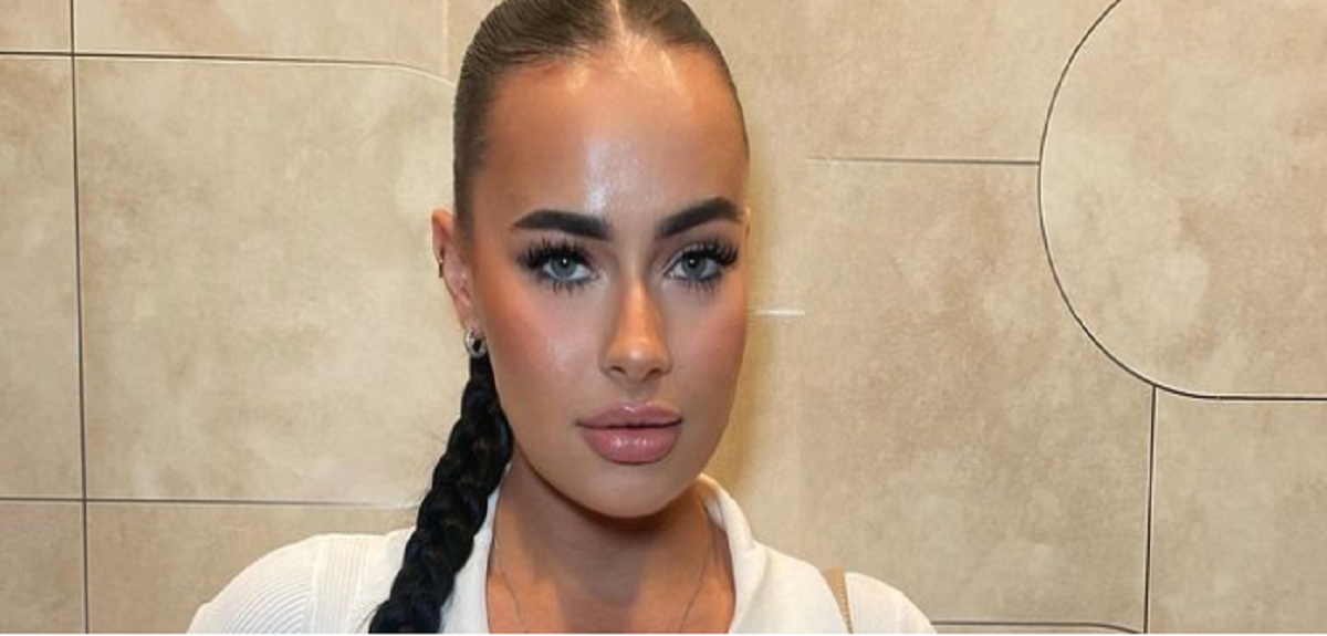 Jessica fik lavet gratis lip filler: Da hun kigger sig i spejlet, får hun et kæmpe chok