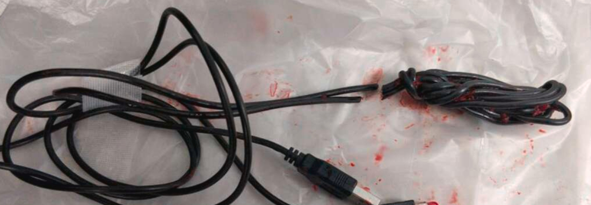 Teenager skulle opereres: Målte indersiden af sin penis med USB-kabel