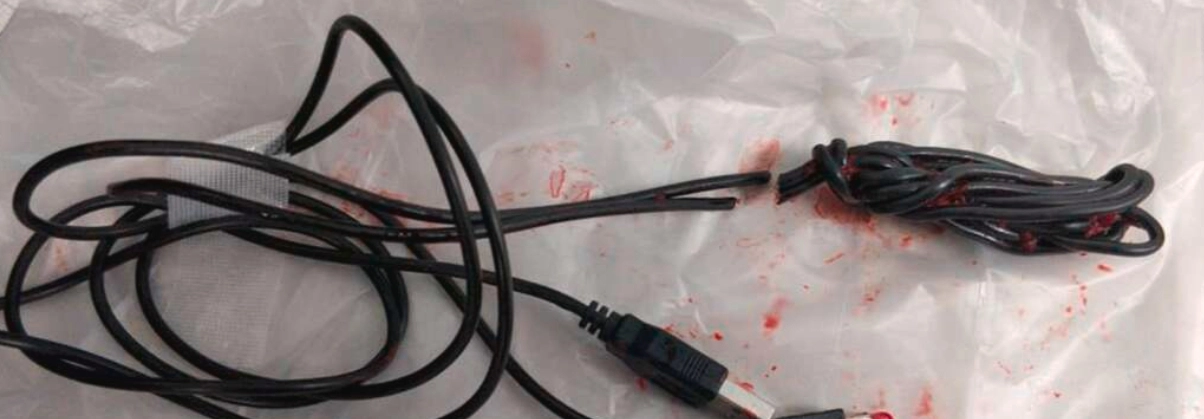 Teenager skulle opereres: Målte indersiden af sin penis med USB-kabel