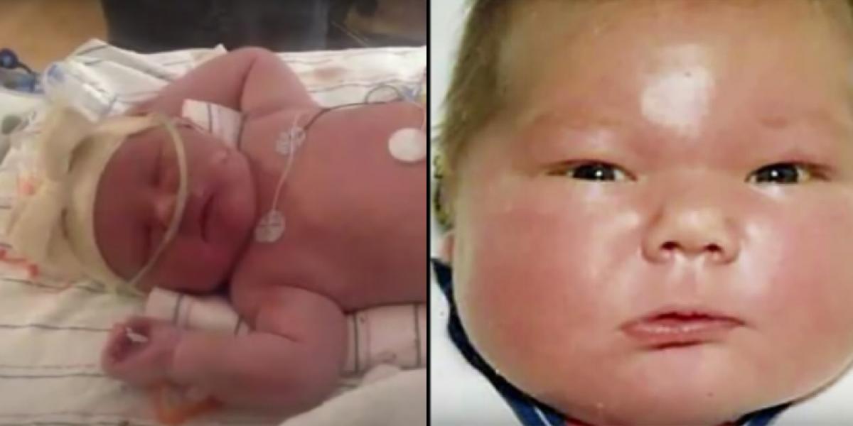 Kæmpe-babyen Kevin tog overskrifter i 80’erne: Sådan ser han ud i dag
