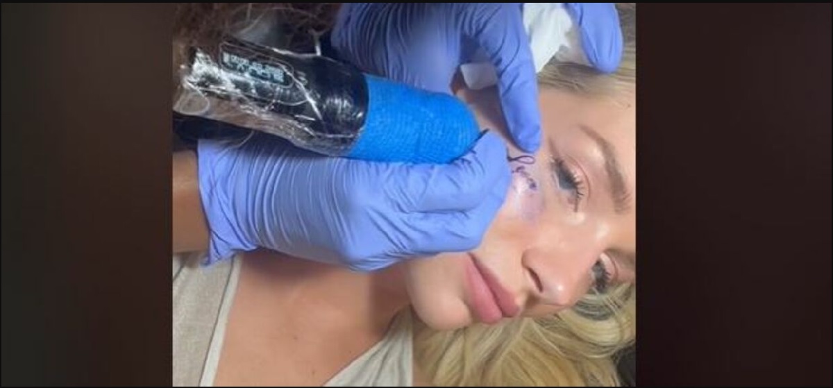 Se videoen: Kate Moss’ søster vågner op til chokerende ansigtstatovering efter vild bytur