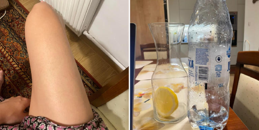 Kvinde drak 3 liter vand om dagen – se så hvad der sker med hendes krop