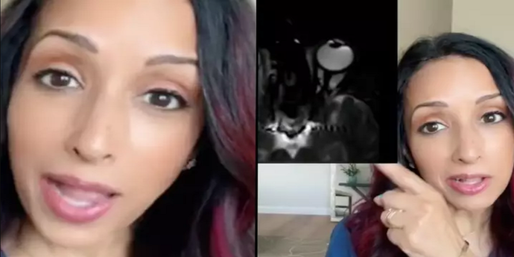 Derfor skal du undgå at gnide dig i øjnene: Kan skade dit syn