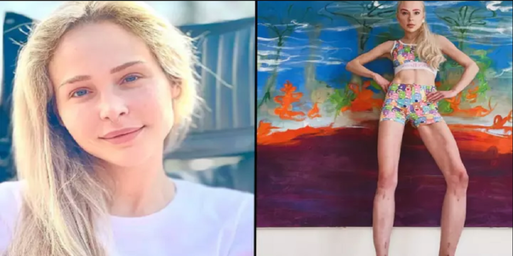 Kvinde har brugt svimlende 1,1 millioner kroner på at blive højere: Nu fortryder hun