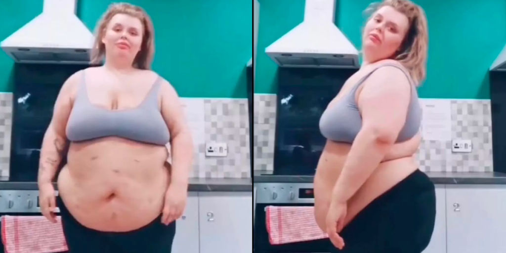 Kvinde ville ikke være tyk som 30-årig: Er ikke til at kende efter vægttab på 88 kg