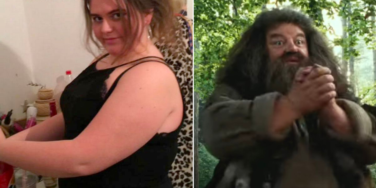Hun blev mobbet med, at hun lignede Hagrid fra Harry Potter: I dag er hun uigenkendelig