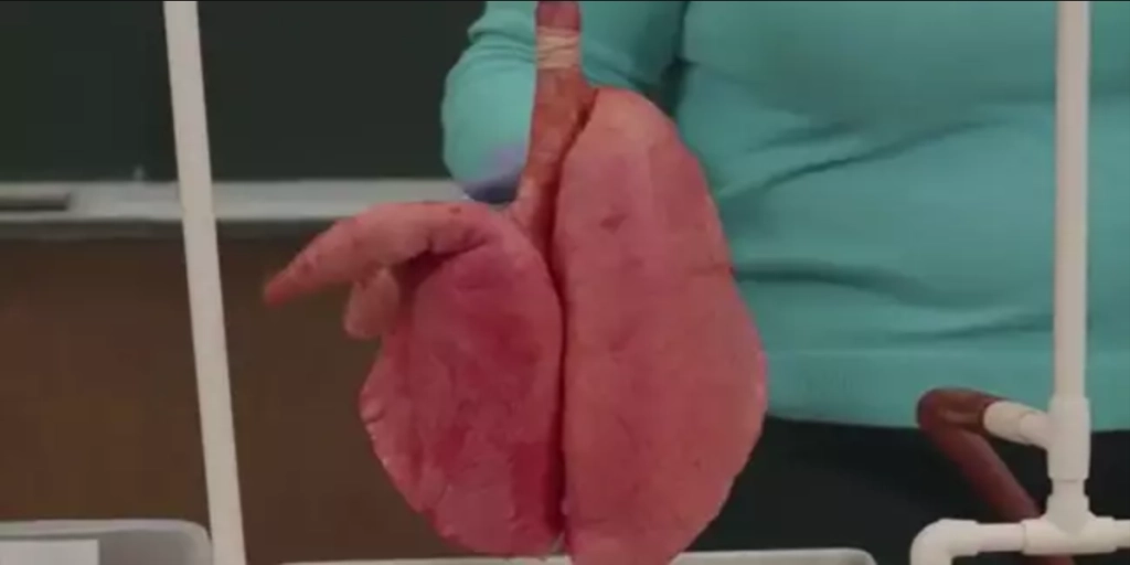Skræmmende video viser forskellen mellem ryger- og ikke rygerlunger