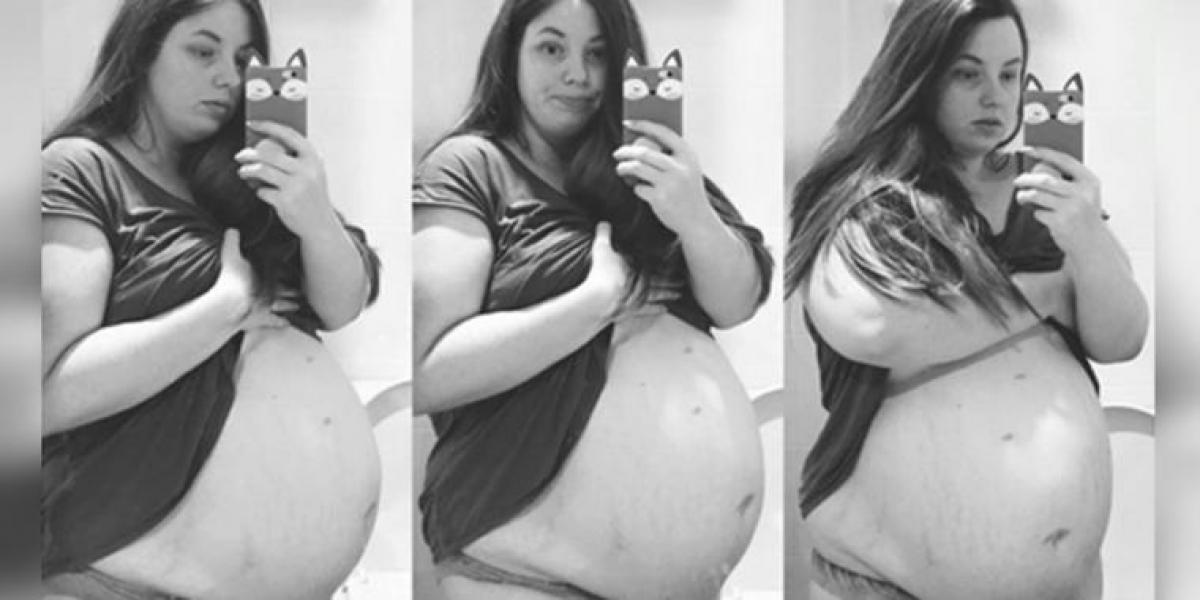 22-årig mor er gravid for fjerde gang – men så afslører lægerne detaljen på ultralydsbilledet