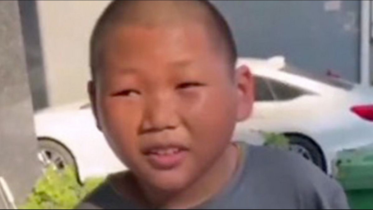 Mand kan ikke få job på grund af sit udseende: Pludselig ændrer heldet sig